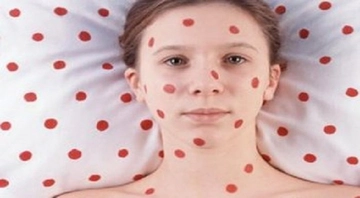 Su Çiçeği Banyo Yapabilir mi?